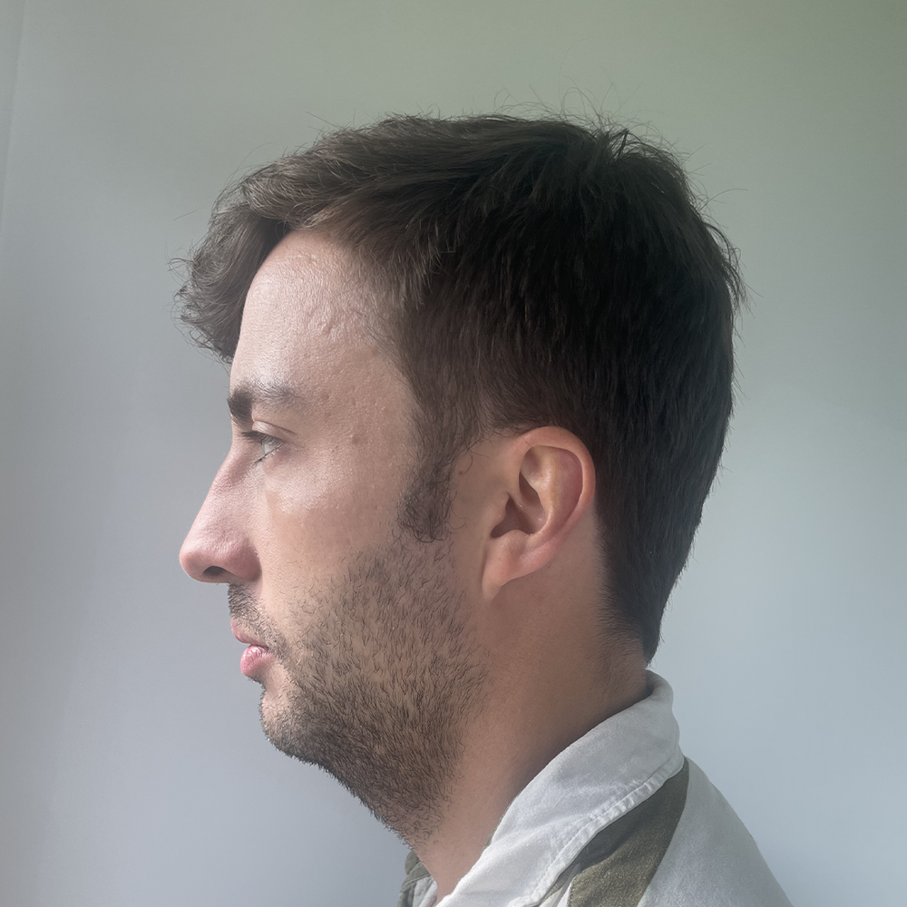 Untrained – Jaw Toner customer photo