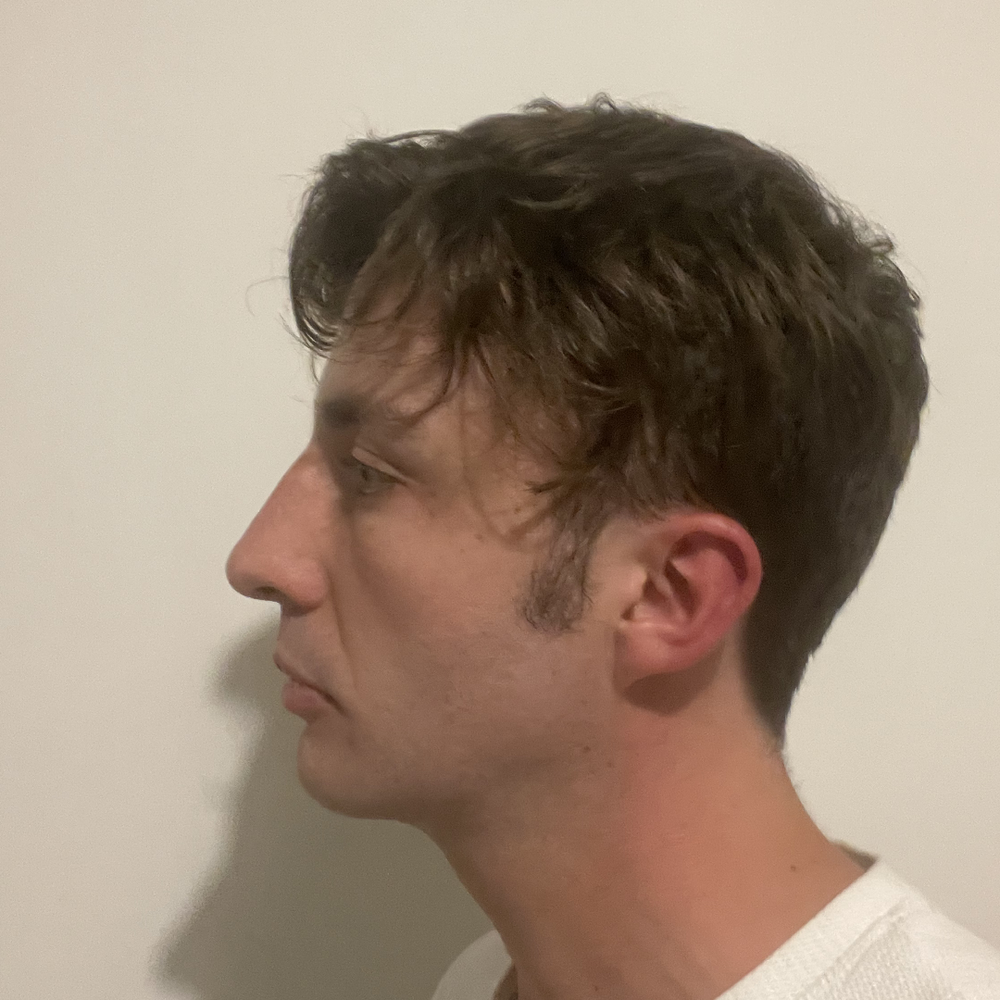 Trained – Jaw Toner customer photo