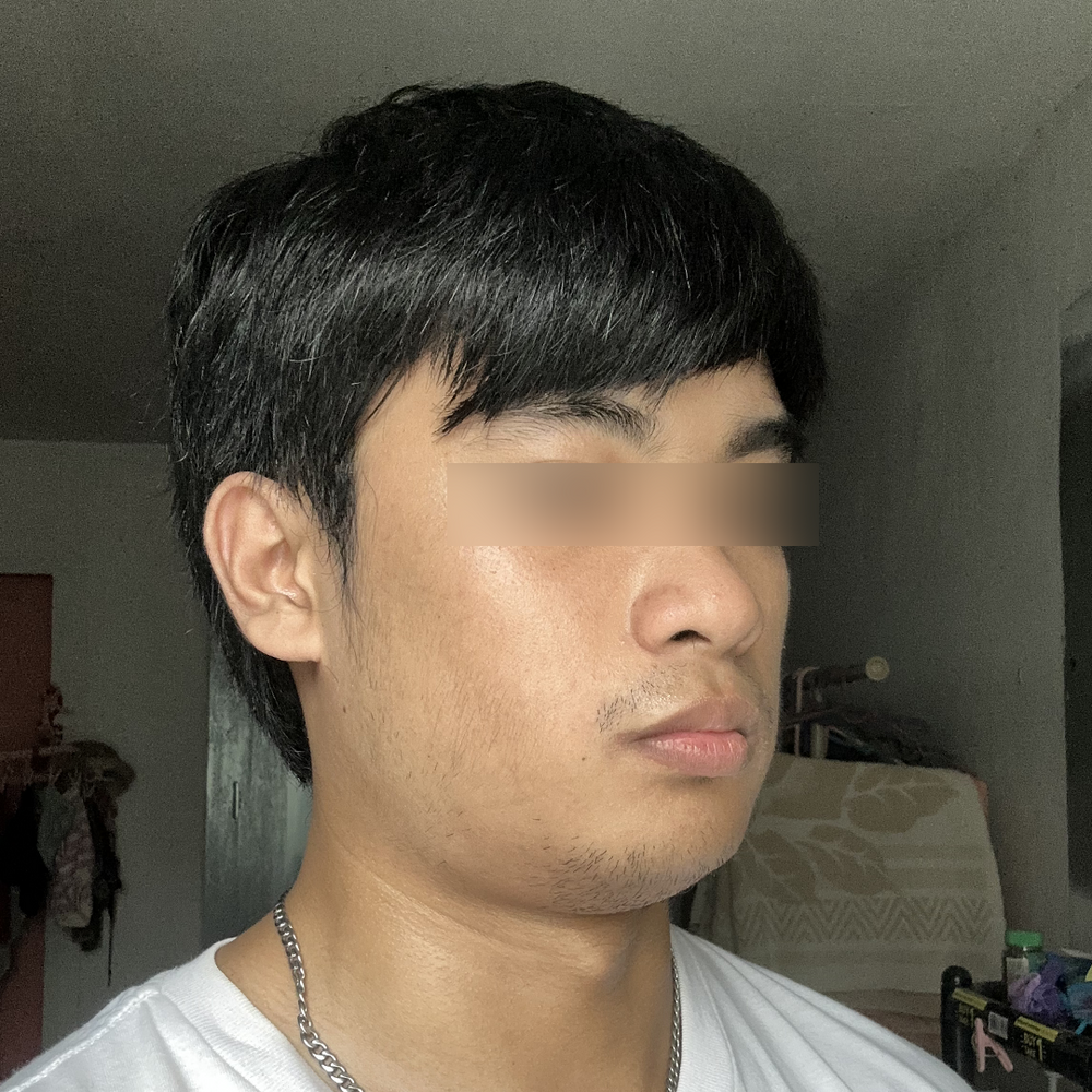 Untrained – Jaw Toner customer photo