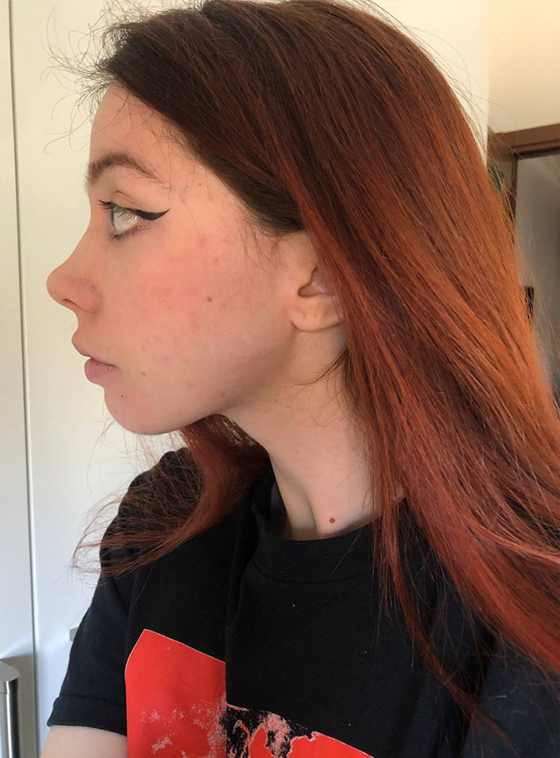 Trained – Jaw Toner customer photo