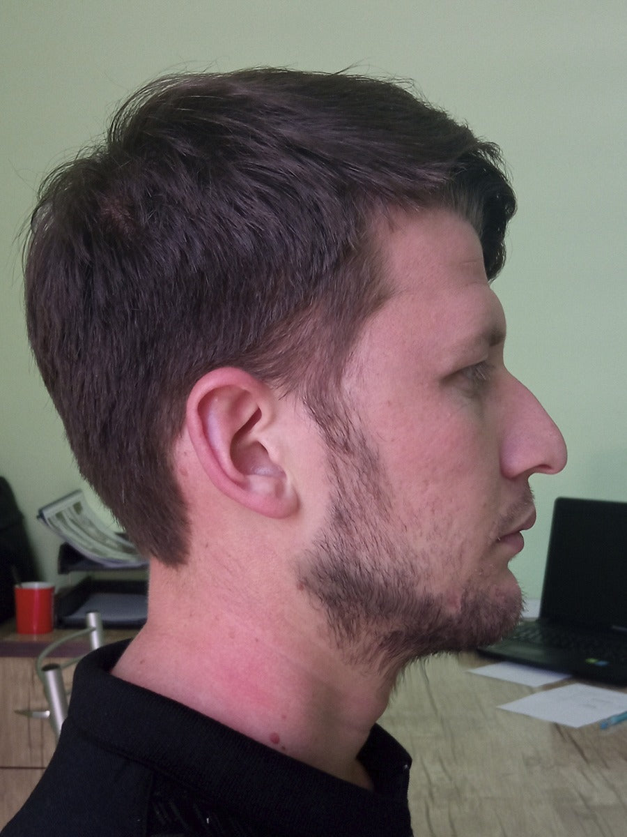 Trained – Jaw Toner customer photo