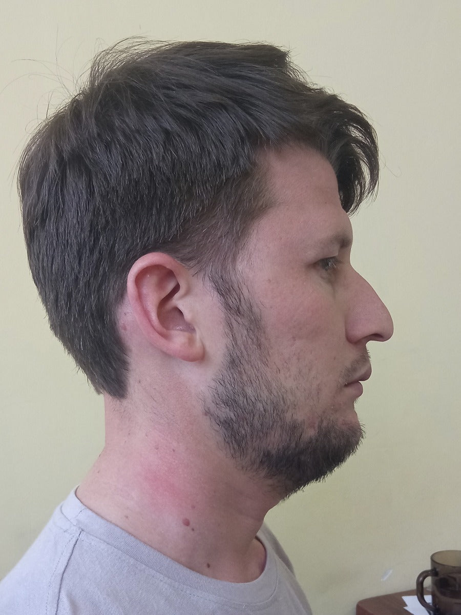 Untrained – Jaw Toner customer photo