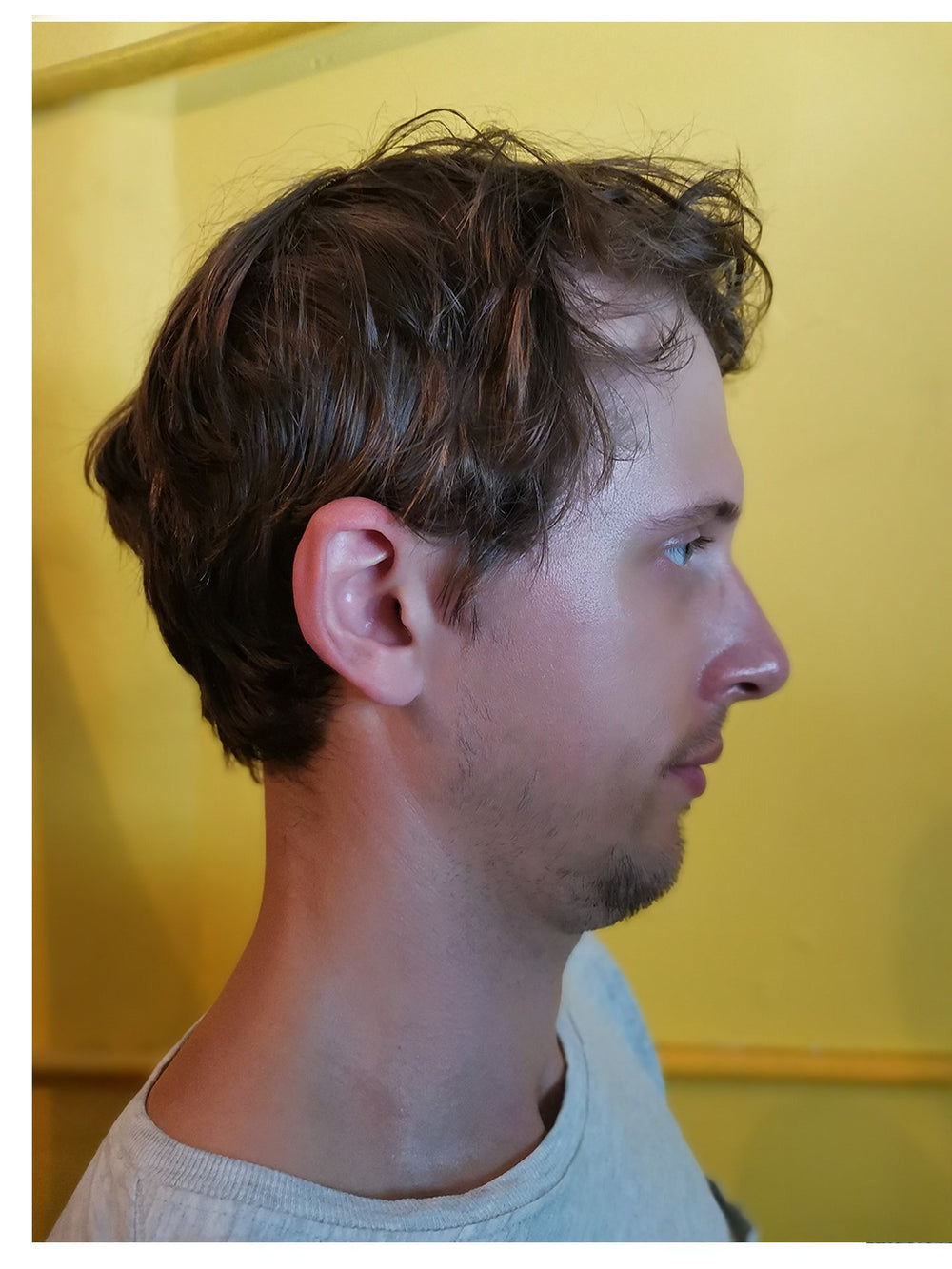 Untrained – Jaw Toner customer photo